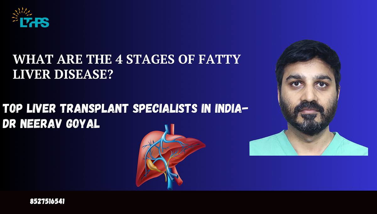 What Are The 4 Stages of Fatty Liver Disease? | by Transplantationliver | Oct, 2024 | Medium