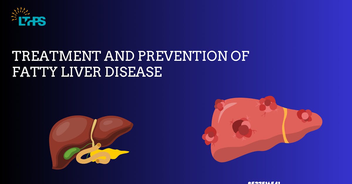 Treatment and Prevention of Fatty Liver Disease